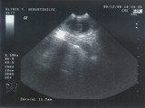 Ula ultrasounds 9 Dec. 2008